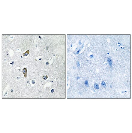 Immunohistochemistry - Anti-CDK5RAP2 Antibody (C12191) - Antibodies.com