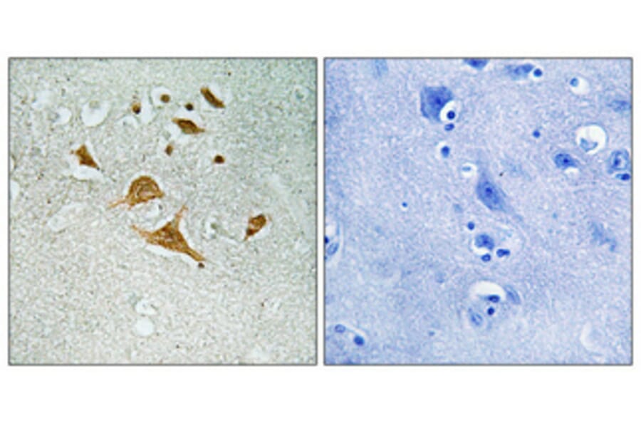 Immunohistochemistry - Anti-CDK5RAP1 Antibody (C12190) - Antibodies.com
