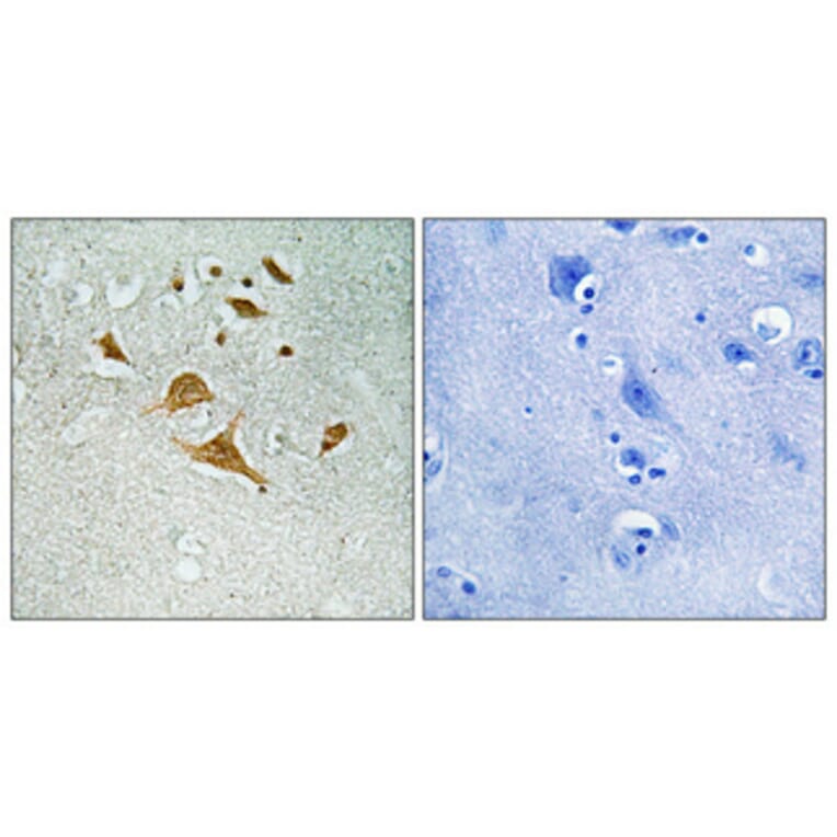 Immunohistochemistry - Anti-CDK5RAP1 Antibody (C12190) - Antibodies.com