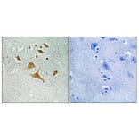 Immunohistochemistry - Anti-CDK5RAP1 Antibody (C12190) - Antibodies.com