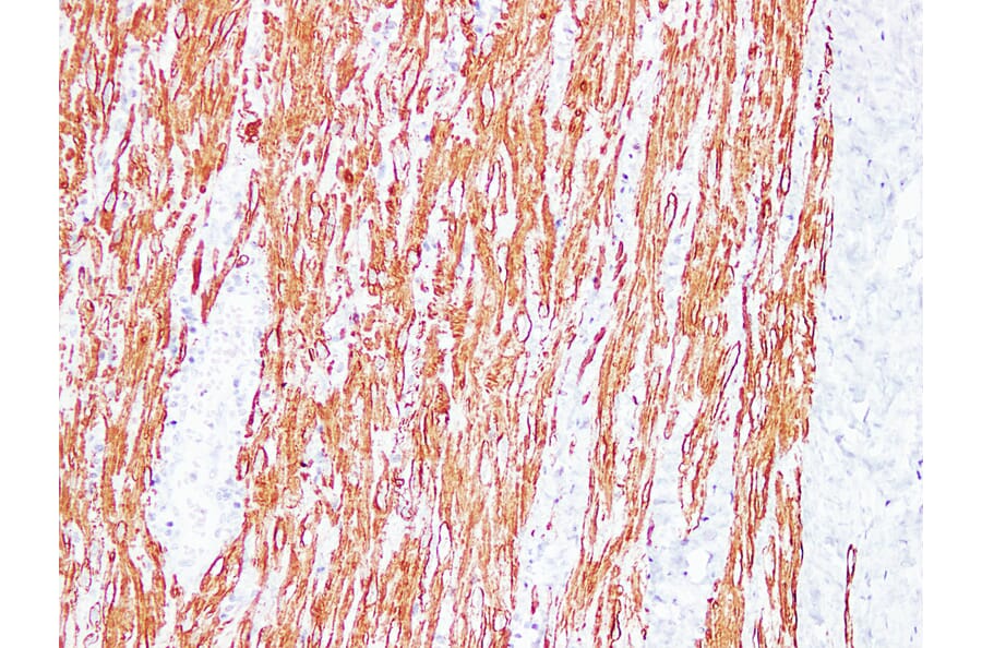 Immunohistochemistry - Anti-Desmin Antibody (V0065) - Antibodies.com