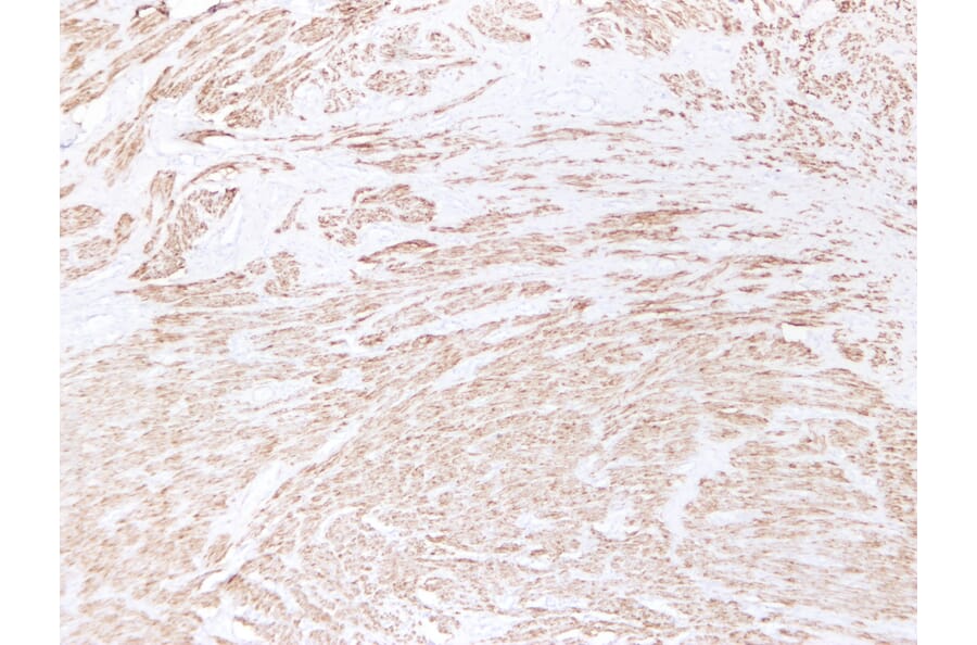 Immunohistochemistry - Anti-Desmin Antibody (V0065) - Antibodies.com
