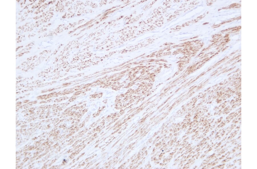 Immunohistochemistry - Anti-Desmin Antibody (V0065) - Antibodies.com