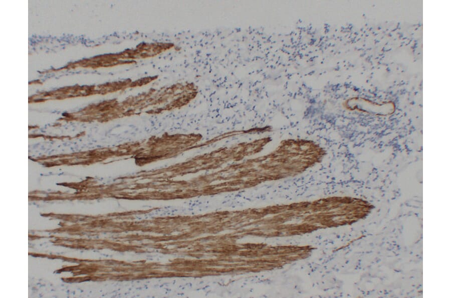 Immunohistochemistry - Anti-Desmin Antibody (V0065) - Antibodies.com