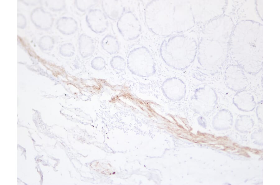 Immunohistochemistry - Anti-Desmin Antibody (V0065) - Antibodies.com