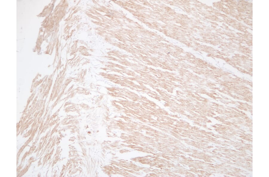 Immunohistochemistry - Anti-Desmin Antibody (V0065) - Antibodies.com