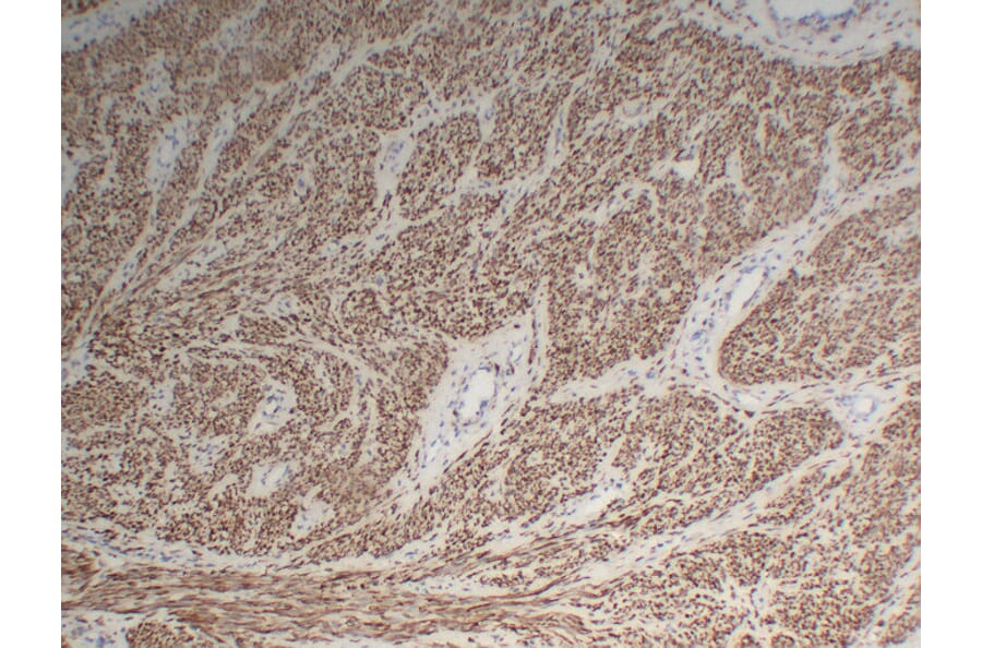 Immunohistochemistry - Anti-Desmin Antibody (V0065) - Antibodies.com