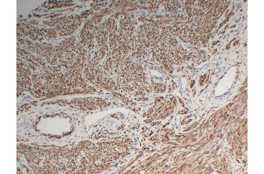 Immunohistochemistry - Anti-Desmin Antibody (V0065) - Antibodies.com