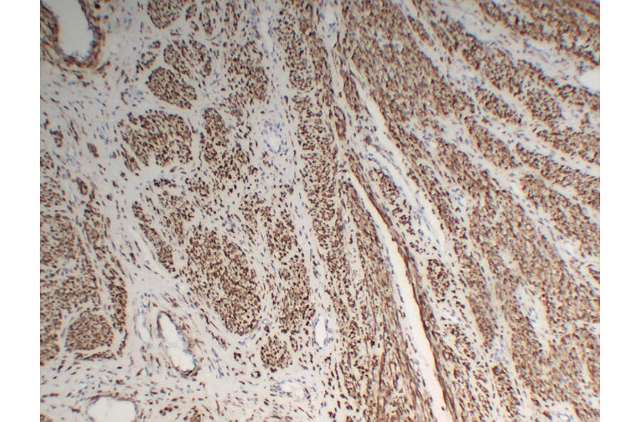 Immunohistochemistry - Anti-Desmin Antibody (V0065) - Antibodies.com