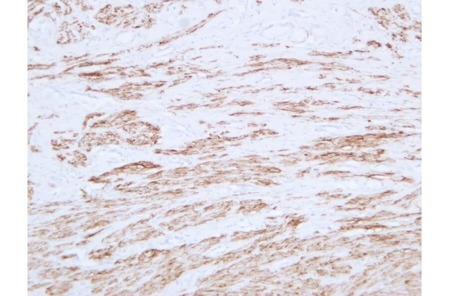 Immunohistochemistry - Anti-Desmin Antibody (V0065) - Antibodies.com
