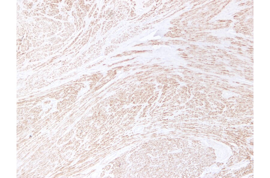 Immunohistochemistry - Anti-Desmin Antibody (V0065) - Antibodies.com