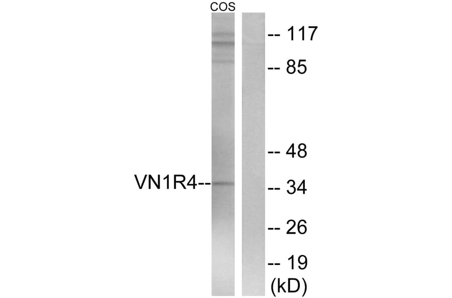 Western Blot - Anti-VN1R4 Antibody (G794) - Antibodies.com