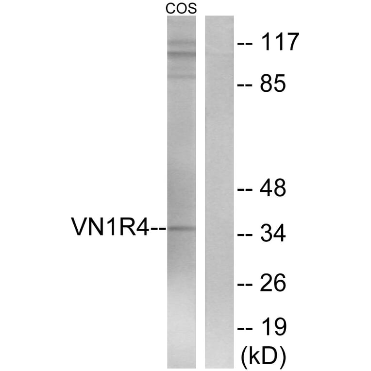 Western Blot - Anti-VN1R4 Antibody (G794) - Antibodies.com