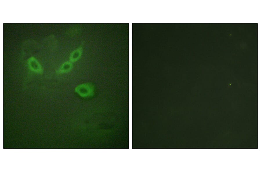 Immunofluorescence - Anti-TUSC5 Antibody (C11319) - Antibodies.com