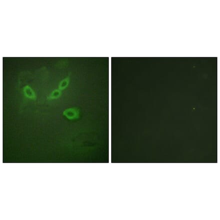 Immunofluorescence - Anti-TUSC5 Antibody (C11319) - Antibodies.com
