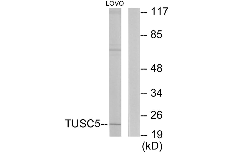 Western Blot - Anti-TUSC5 Antibody (C11319) - Antibodies.com