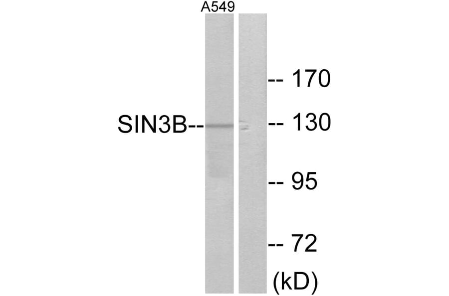 Western Blot - Anti-SIN3B Antibody (C10163) - Antibodies.com