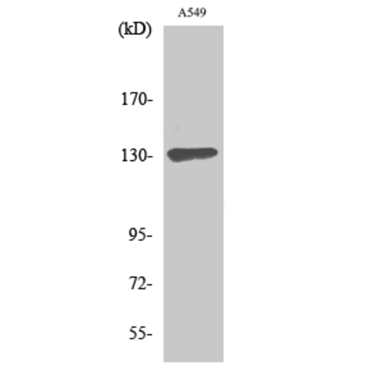 Western Blot - Anti-SIN3B Antibody (C10163) - Antibodies.com