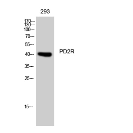 Western Blot - Anti-PTGDR Antibody (G940) - Antibodies.com