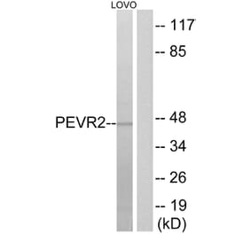 Western Blot - Anti-PEVR2 Antibody (G723) - Antibodies.com