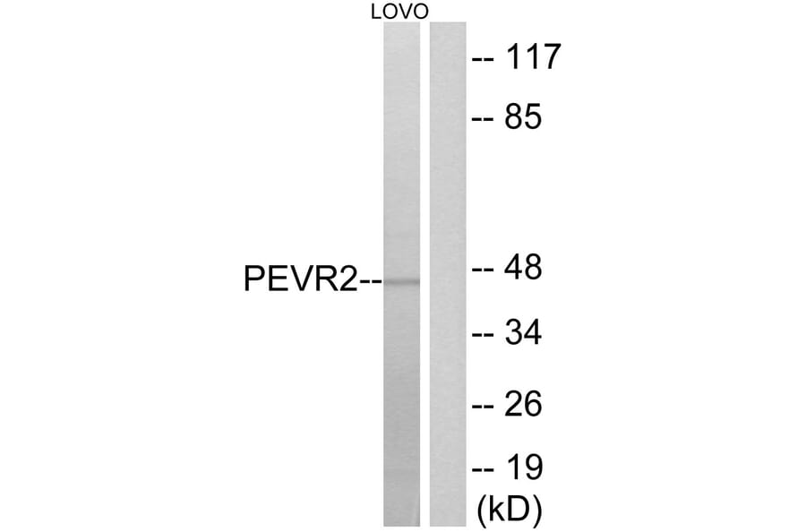 Western Blot - Anti-PEVR2 Antibody (G723) - Antibodies.com