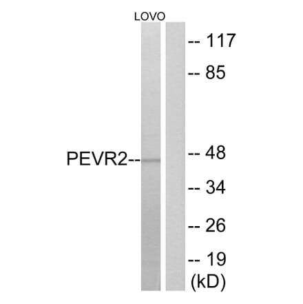 Western Blot - Anti-PEVR2 Antibody (G723) - Antibodies.com