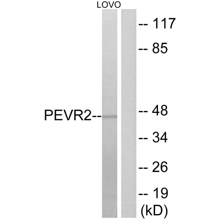 Western Blot - Anti-PEVR2 Antibody (G723) - Antibodies.com