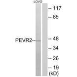 Western Blot - Anti-PEVR2 Antibody (G723) - Antibodies.com