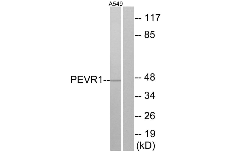 Western Blot - Anti-PEVR1 Antibody (G722) - Antibodies.com