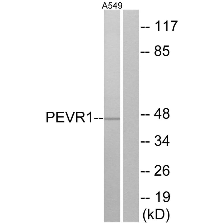 Western Blot - Anti-PEVR1 Antibody (G722) - Antibodies.com