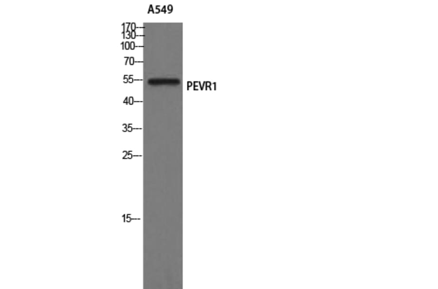 Western Blot - Anti-PEVR1 Antibody (G722) - Antibodies.com