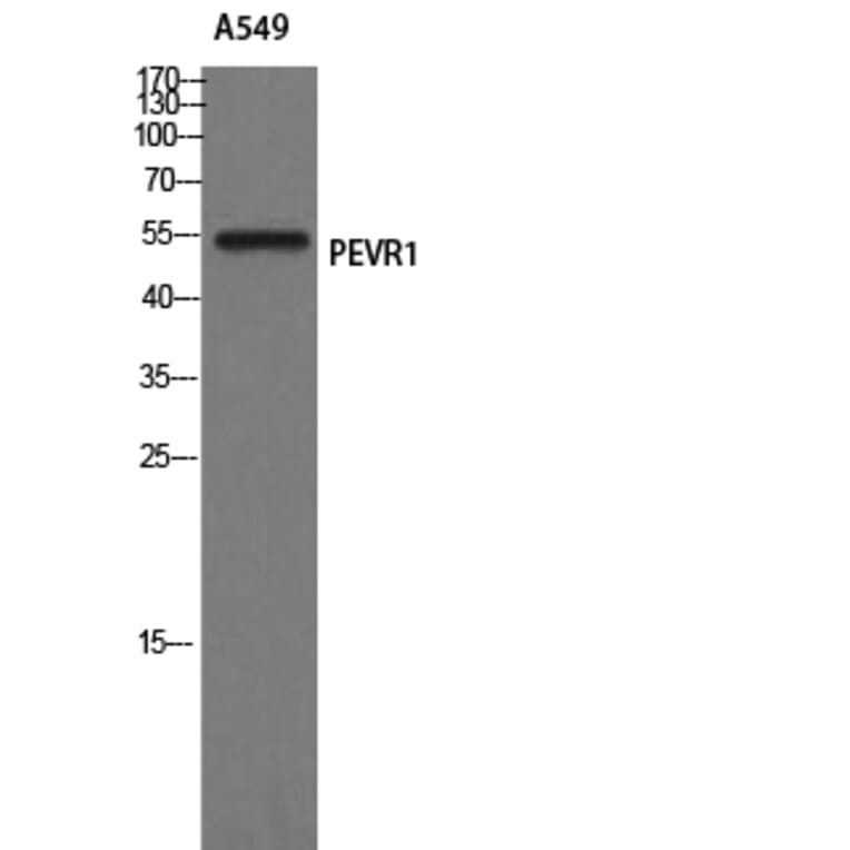 Western Blot - Anti-PEVR1 Antibody (G722) - Antibodies.com