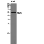 Western Blot - Anti-PEVR1 Antibody (G722) - Antibodies.com