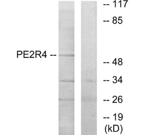 Western Blot - Anti-PE2R4 Antibody (G099) - Antibodies.com