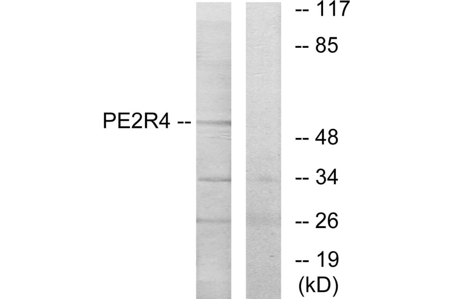Western Blot - Anti-PE2R4 Antibody (G099) - Antibodies.com