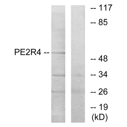 Western Blot - Anti-PE2R4 Antibody (G099) - Antibodies.com