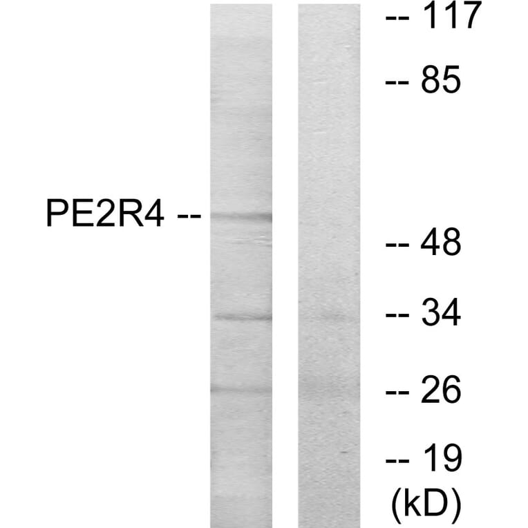 Western Blot - Anti-PE2R4 Antibody (G099) - Antibodies.com