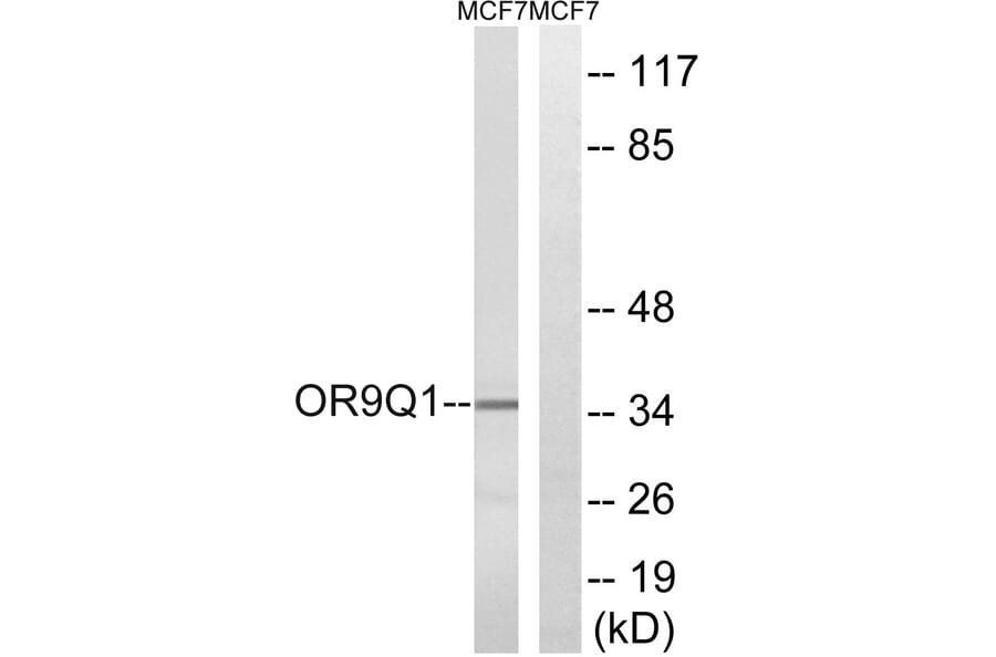 Western Blot - Anti-OR9Q1 Antibody (G701) - Antibodies.com