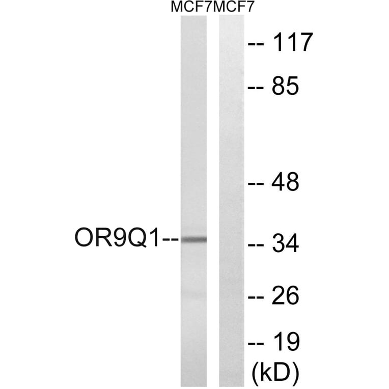 Western Blot - Anti-OR9Q1 Antibody (G701) - Antibodies.com