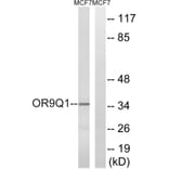 Western Blot - Anti-OR9Q1 Antibody (G701) - Antibodies.com