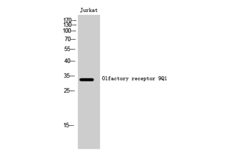 Western Blot - Anti-OR9Q1 Antibody (G701) - Antibodies.com