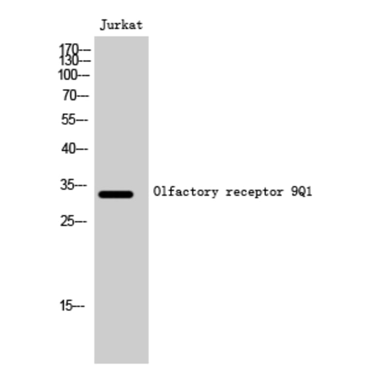 Western Blot - Anti-OR9Q1 Antibody (G701) - Antibodies.com