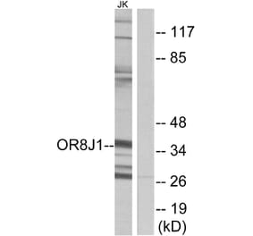 Western Blot - Anti-OR8J1 Antibody (G691) - Antibodies.com