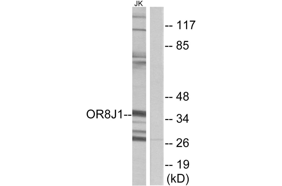 Western Blot - Anti-OR8J1 Antibody (G691) - Antibodies.com