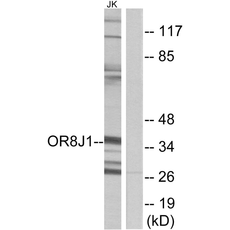 Western Blot - Anti-OR8J1 Antibody (G691) - Antibodies.com