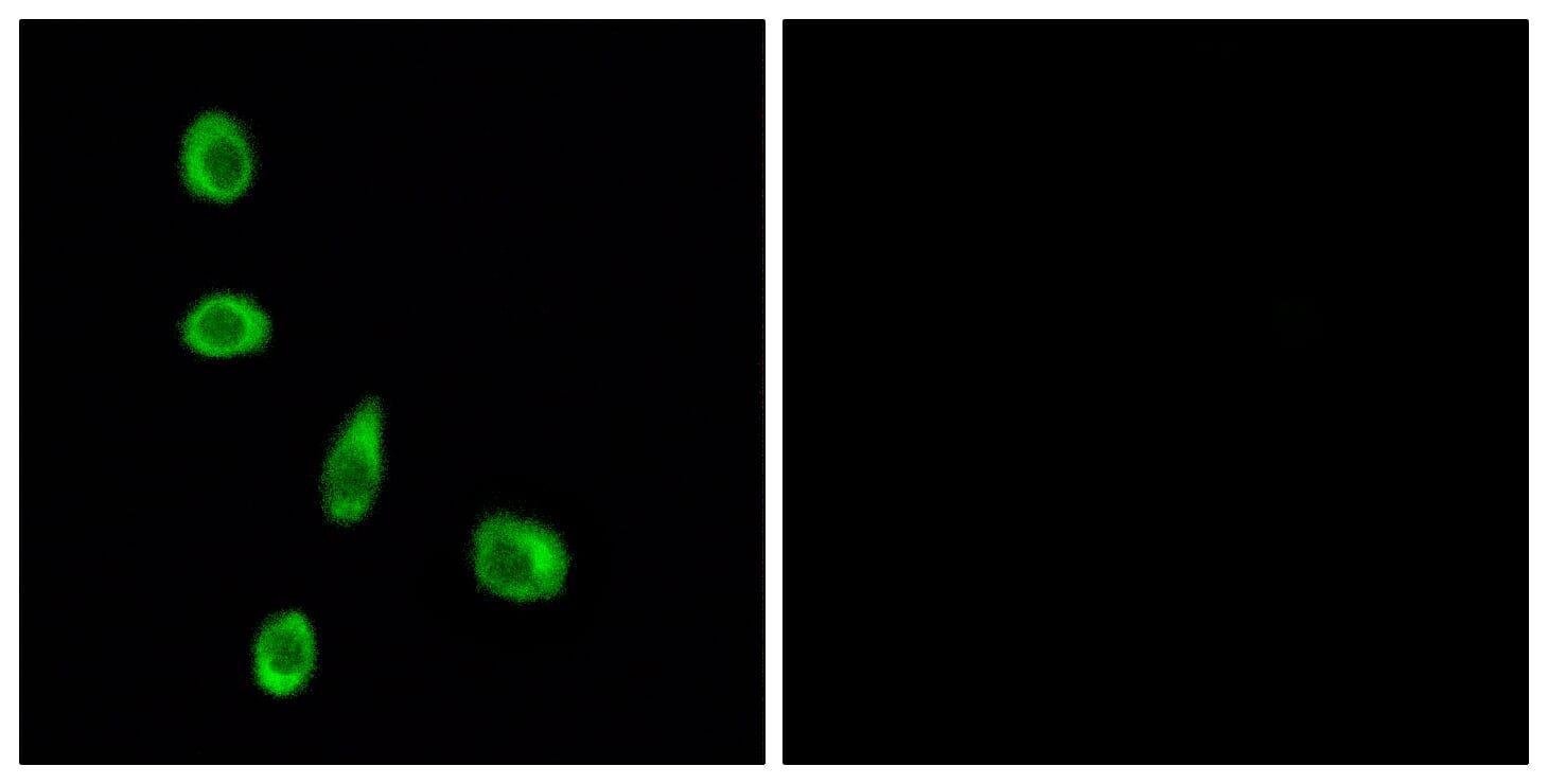 Immunofluorescence analysis of MCF7 cells using Anti-OR8J1 Antibody. The right hand panel represents a negative control, where the antibody was pre-incubated with the immunising peptide.