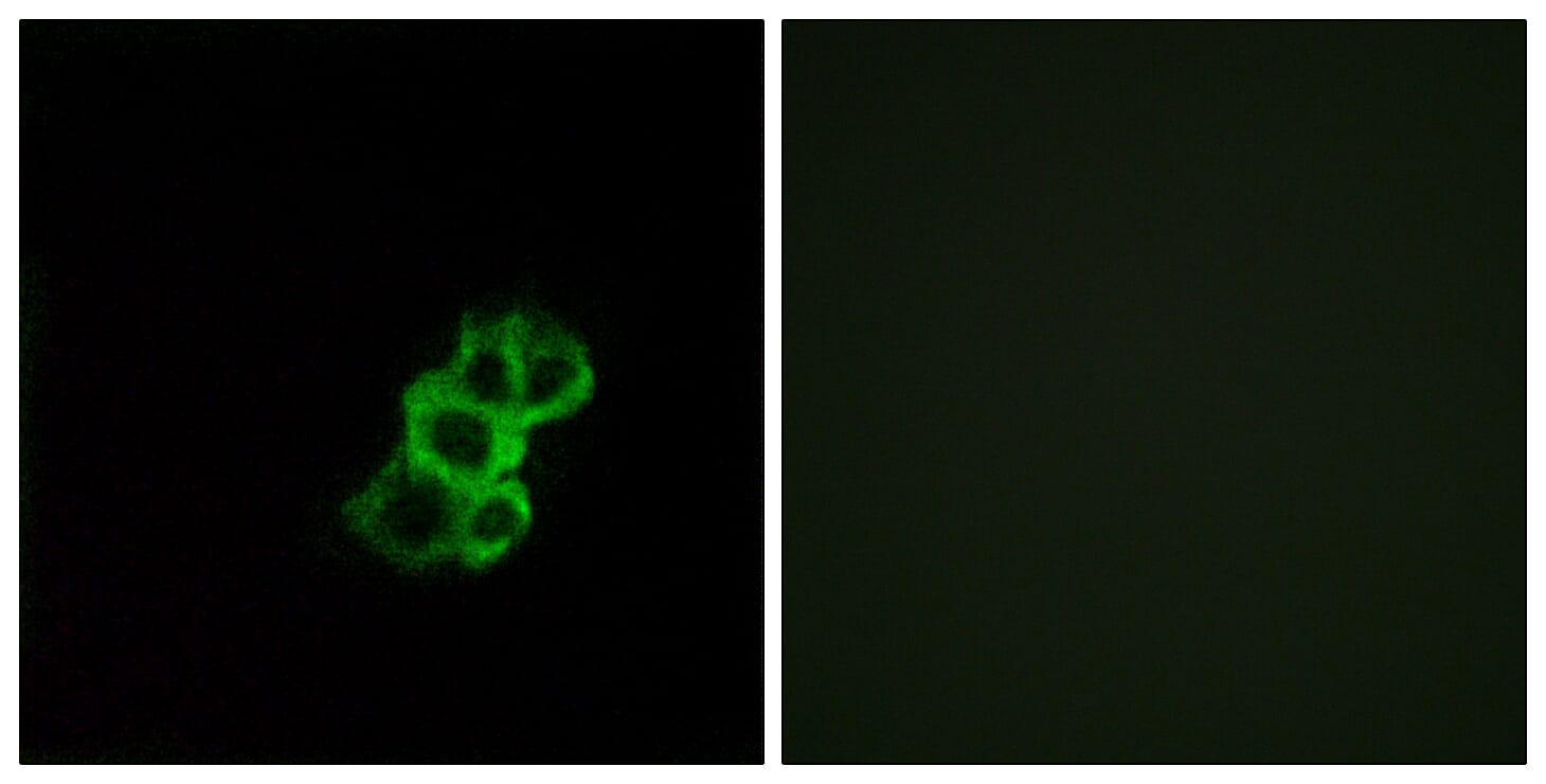 Immunofluorescence analysis of MCF7 cells using Anti-OR8B4 Antibody. The right hand panel represents a negative control, where the antibody was pre-incubated with the immunising peptide.