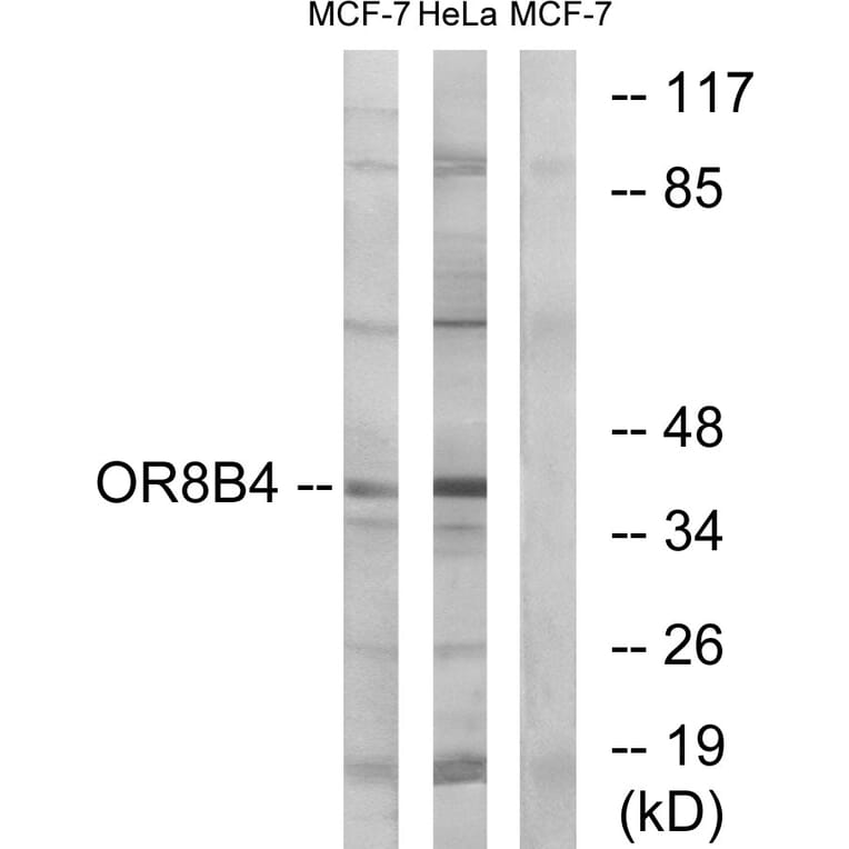 Western Blot - Anti-OR8B4 Antibody (G929) - Antibodies.com