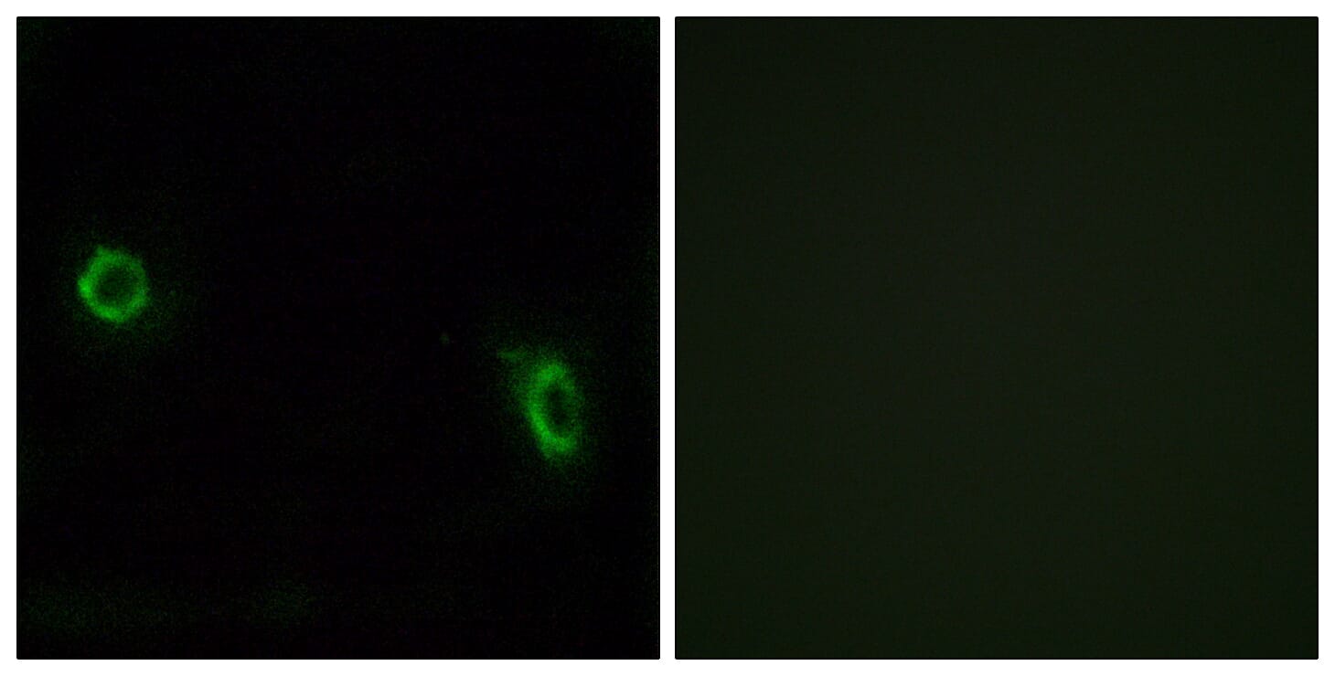 Immunofluorescence analysis of MCF7 cells using Anti-OR6J1 Antibody. The right hand panel represents a negative control, where the antibody was pre-incubated with the immunising peptide.