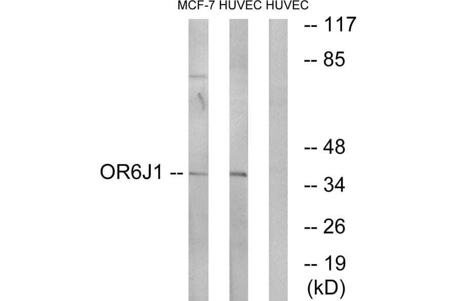 Western Blot - Anti-OR6J1 Antibody (G922) - Antibodies.com
